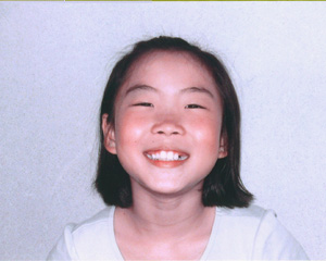  ǎ삳